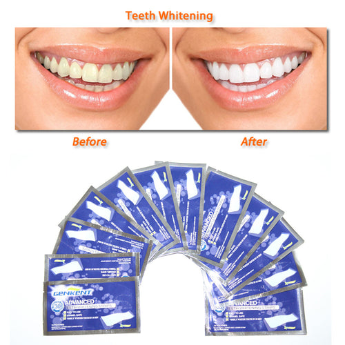 Teeth Supreme Whitening Strips